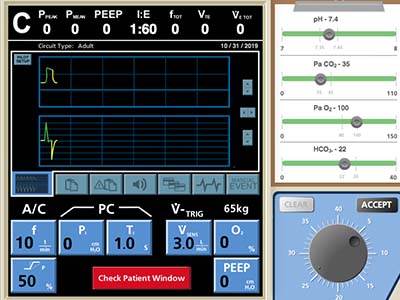 Ventilator Example Thumbnail